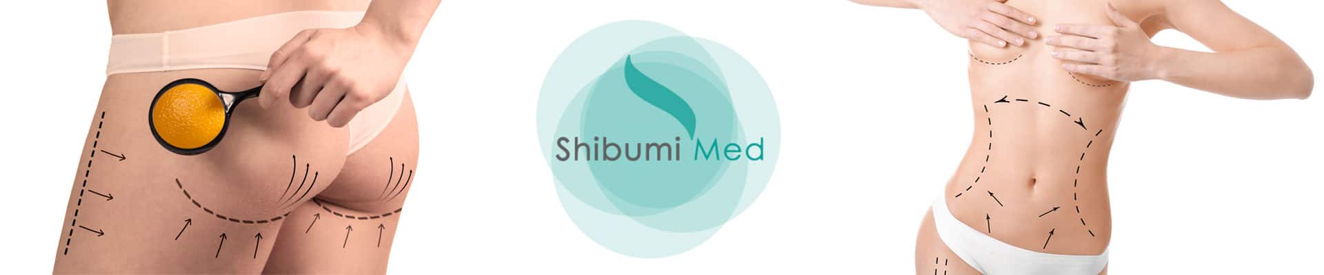 Medicina Estetica Corpo Torino ShibumiMed